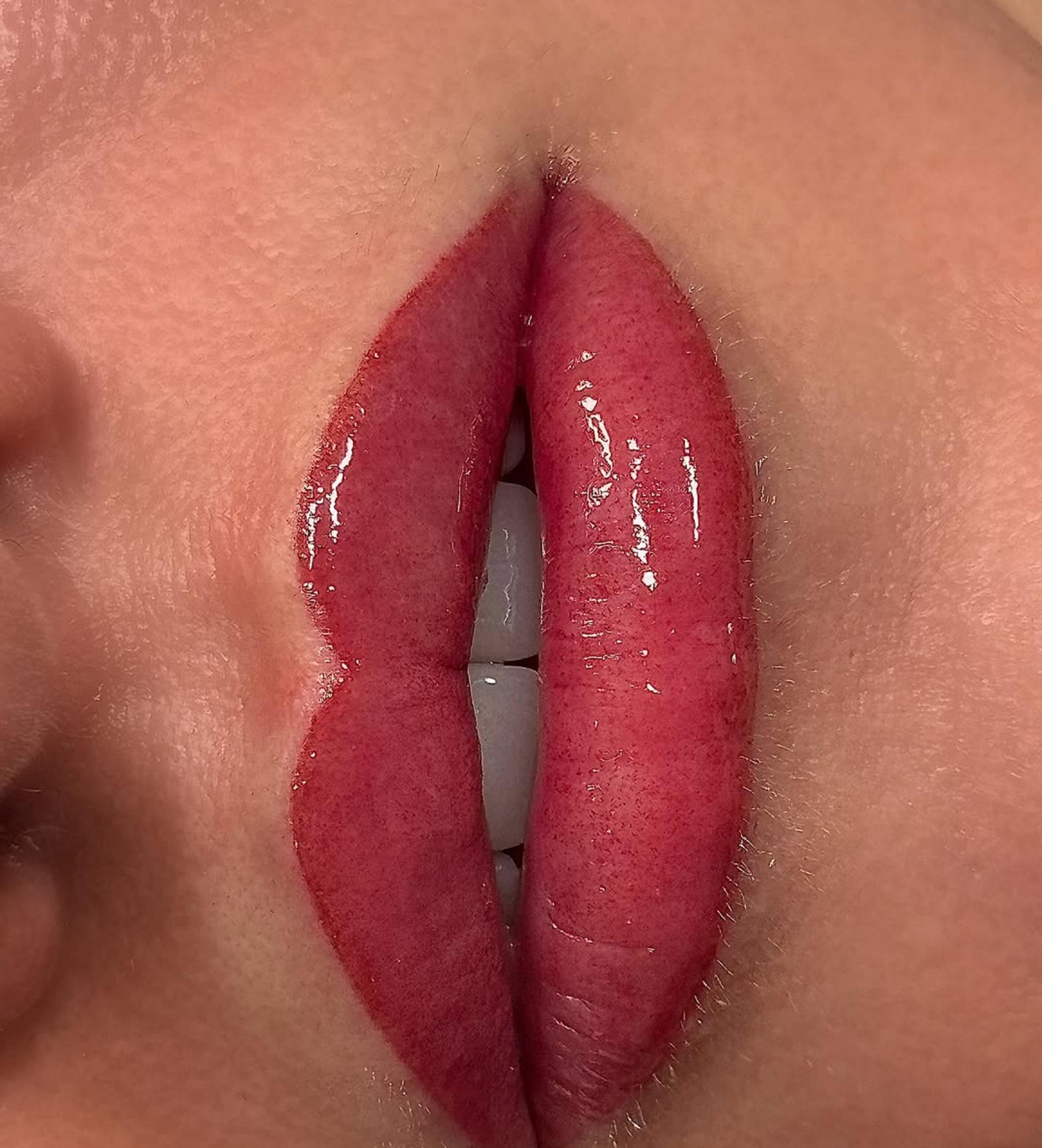 before and after lip blush results
