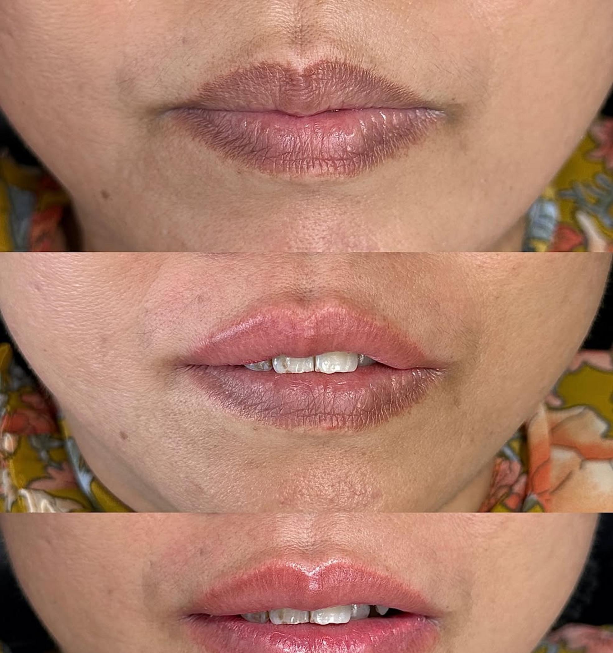 before and after ombre lip tattoo healing