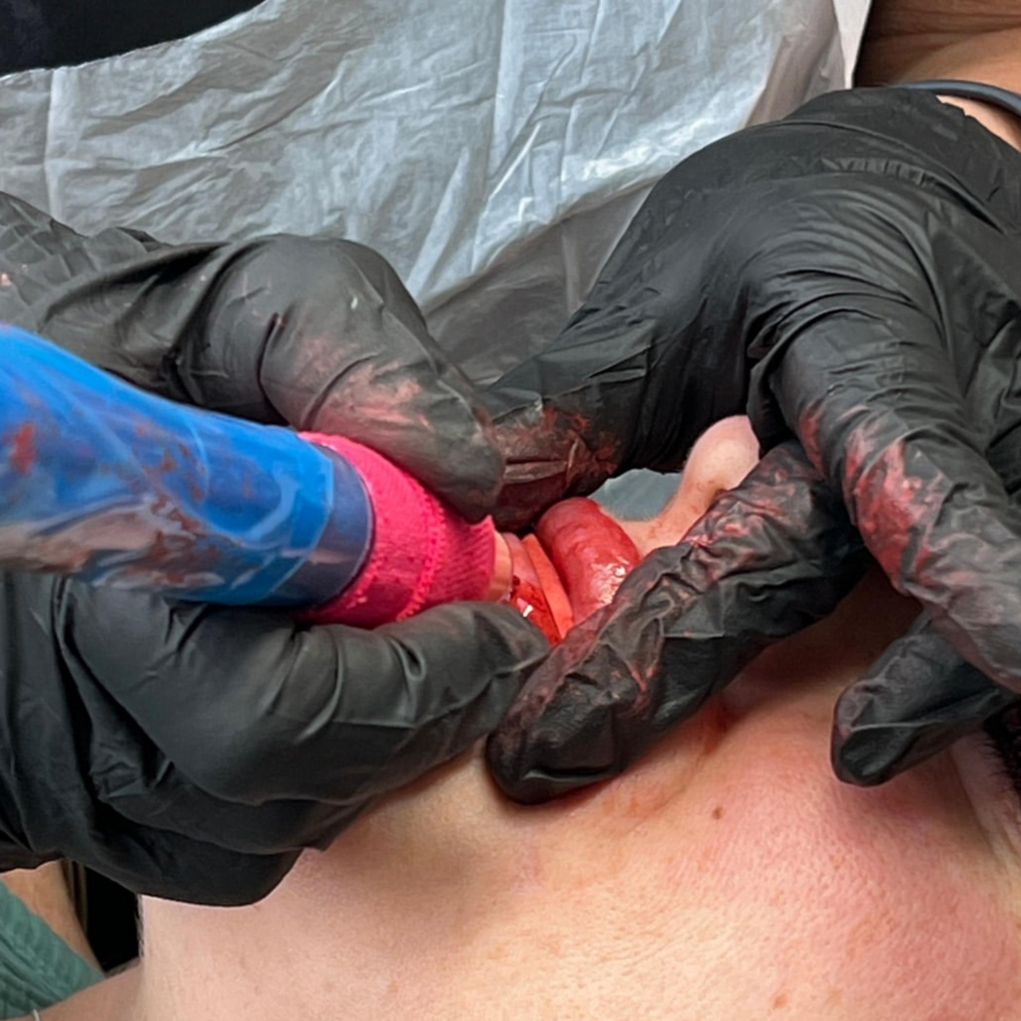 ombre lip tattoo before after healing