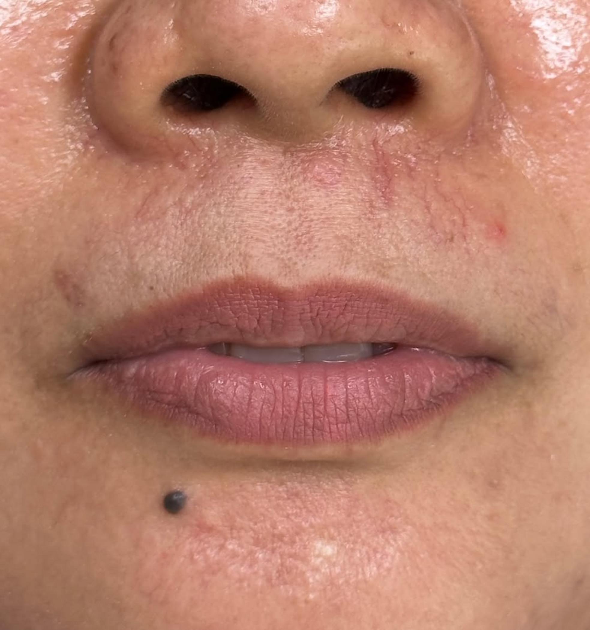 ombre lip tattoo before and after