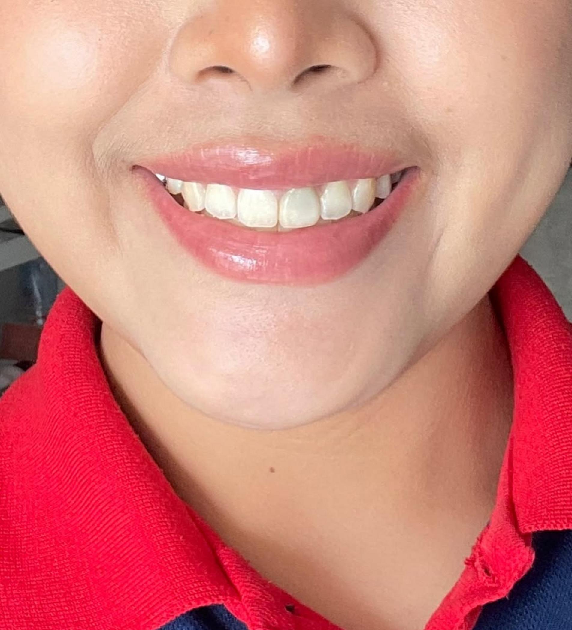 ombre lip tattoo before and after australia